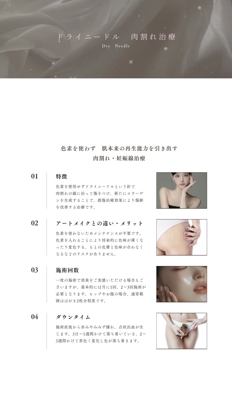 ドライニードル